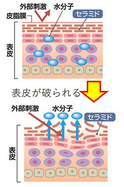 皮膚の損傷